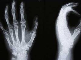 15 Amazing Science Discoveries Inspired By Complete Accidents
